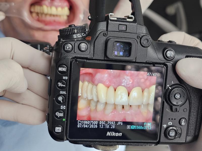 Trapano & macchina fotografica Trapano & macchina fotografica