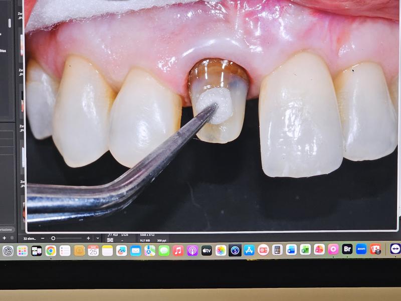 Trapano & macchina fotografica Trapano & macchina fotografica