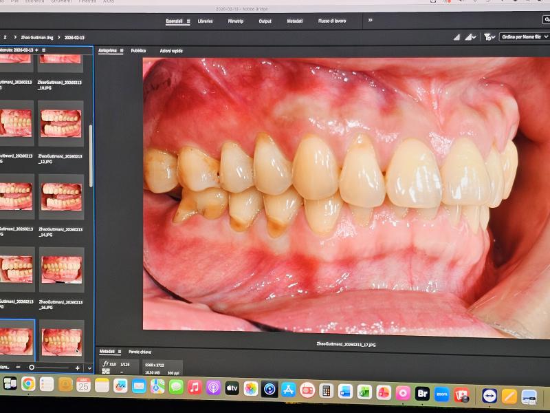 Trapano & macchina fotografica Trapano & macchina fotografica